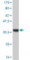 ATOX1 Antibody (monoclonal) (M01)